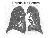Pulmonary Fibrosis Four Months after COVID-19 is Associated with Severity of Illness and Blood Leukocyte Telomere Length